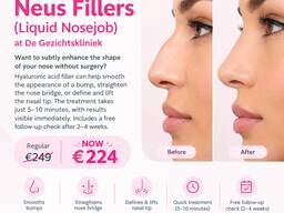 Tien procent korting op neusfillers (liquid nosejob) bij de gezichtskliniek!